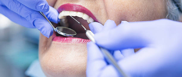 Dentist for Dental Trauma in MS